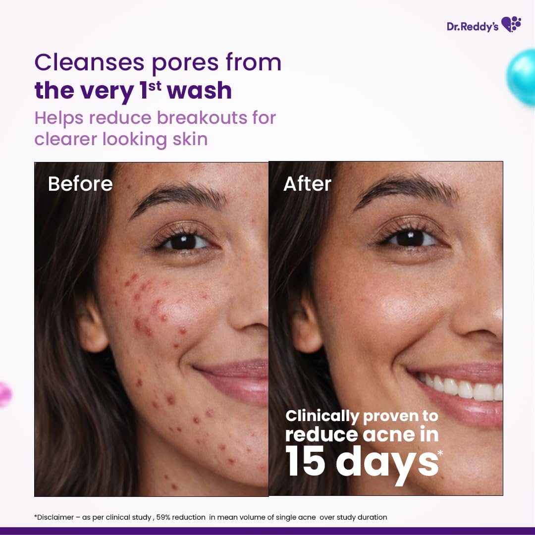 Dr. Reddy's Venusia Acne Face Wash - 75Gm Beauty Bumble
