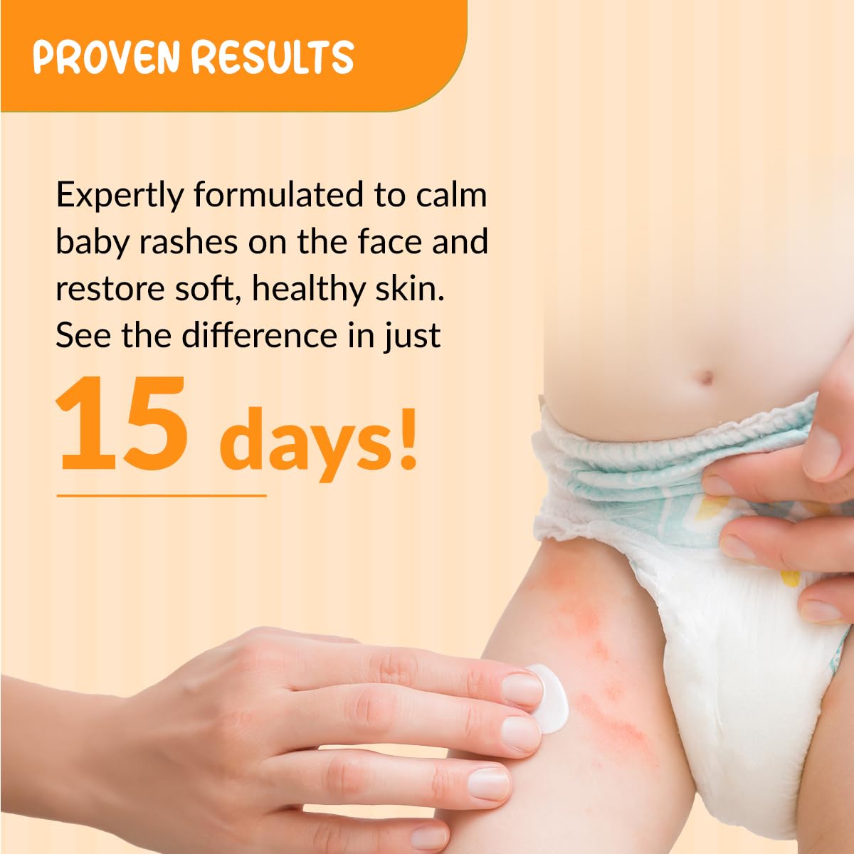 Fixderma Hoopoe Diaper Rash Cream for baby with Zinc Oxide & Panthenol | Prevent Rashes, Redness & Irritation | Baby Rash Cream | Dermatologist Tested (50G) FIX DERMA