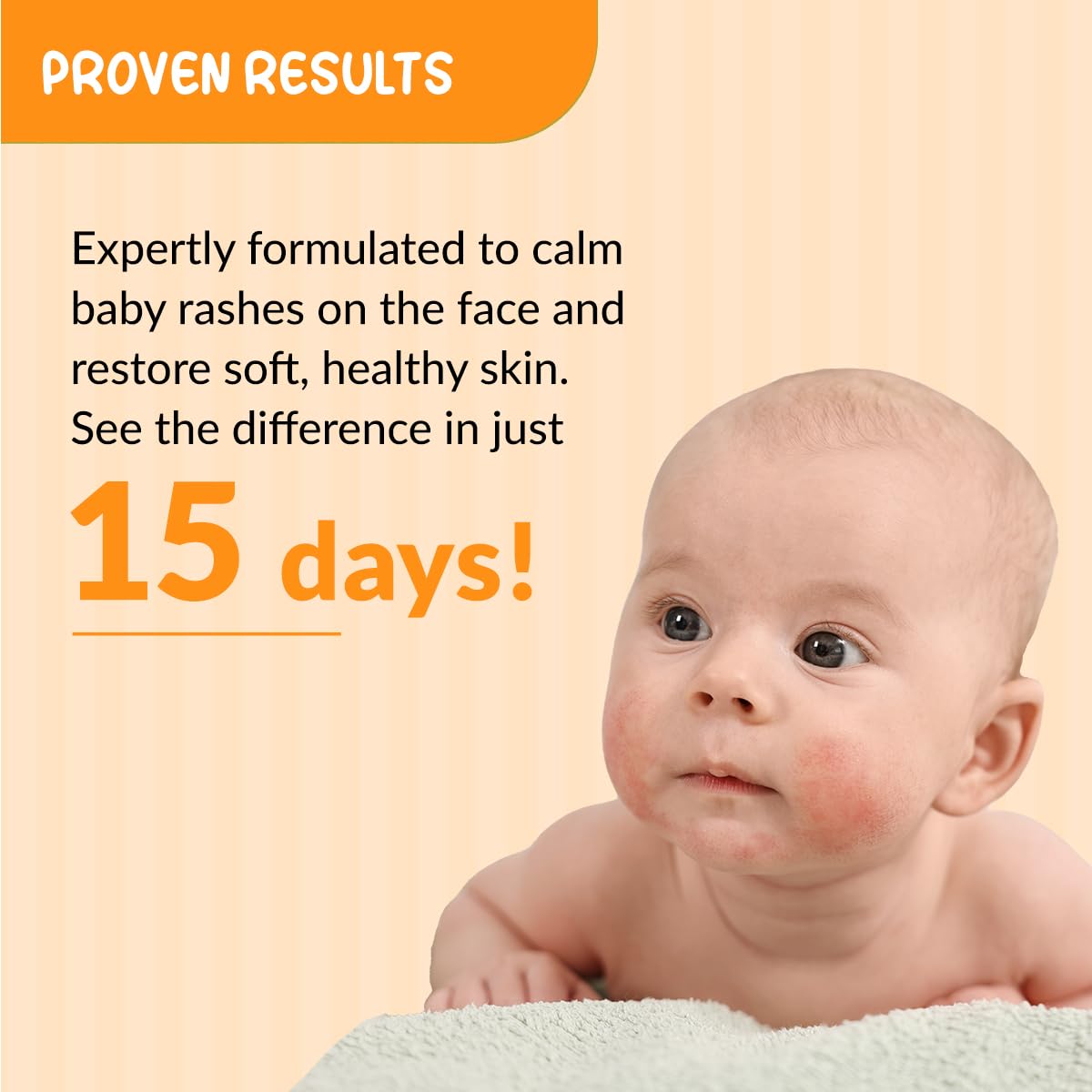 Hoopoe Anti Rash Face Cream 50 G FIX DERMA