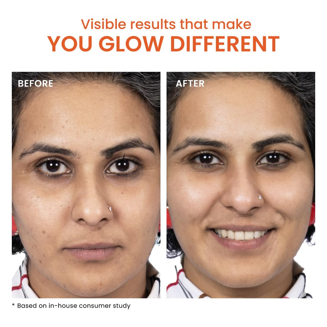 Foxtale Collagen-PDRN Cell Renewal Serum | Collagen + PDRN + Niacinamide + Polyglutamic Acid | Boosts Cell Renewal, Firms & Plumps Skin, Deeply Hydrates & Strengthens Barrier for Smooth, Glass-Skin Glow | For All Skin Types | 30 ml FOXTALE