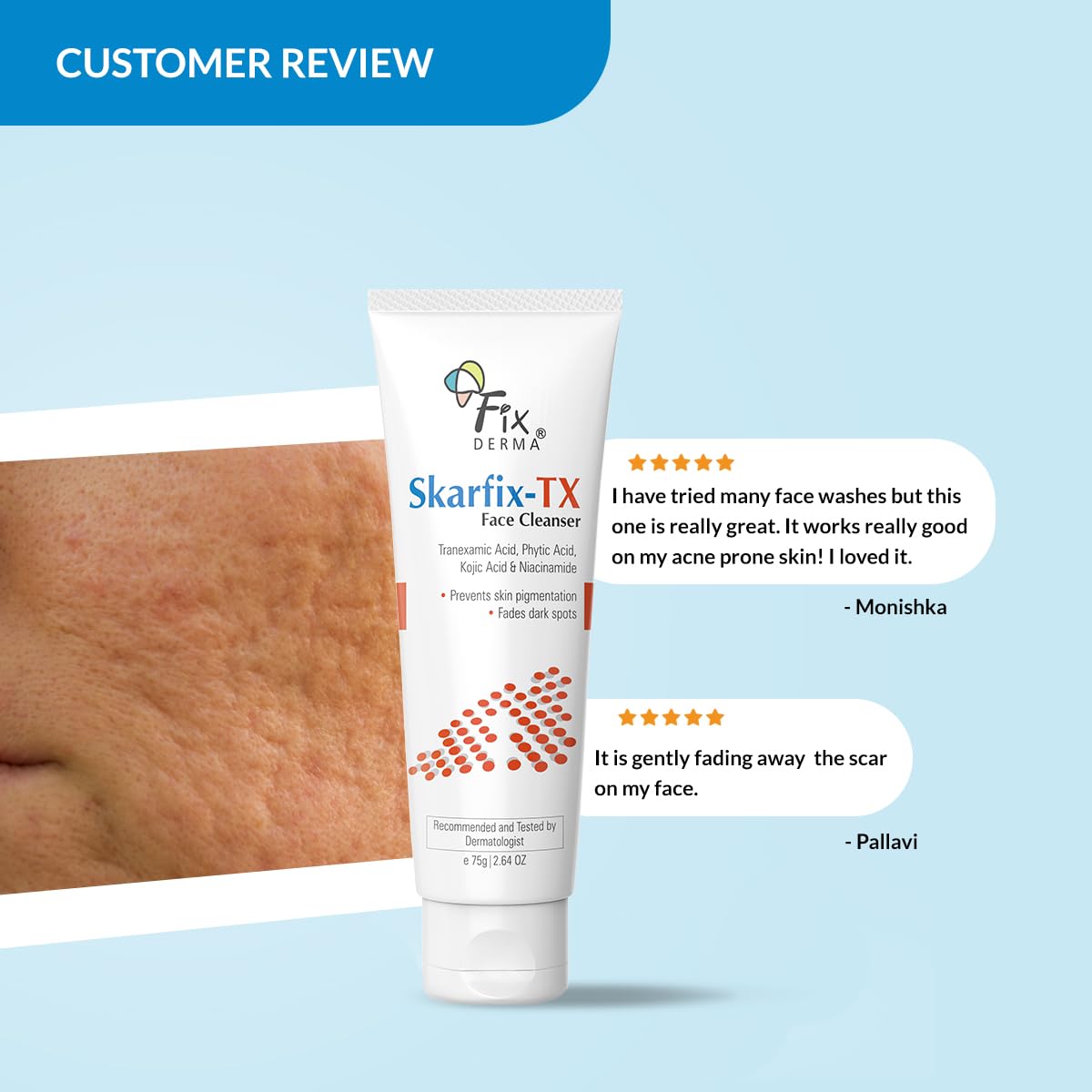 Fixderma Skarfix -TX Face Cleanser with Tranexamic Acid, Kojic Acid & Niacinamide | Kojic Acid Face Wash | Pigmentation Face Wash for All Skin Types - 75gm FIX DERMA
