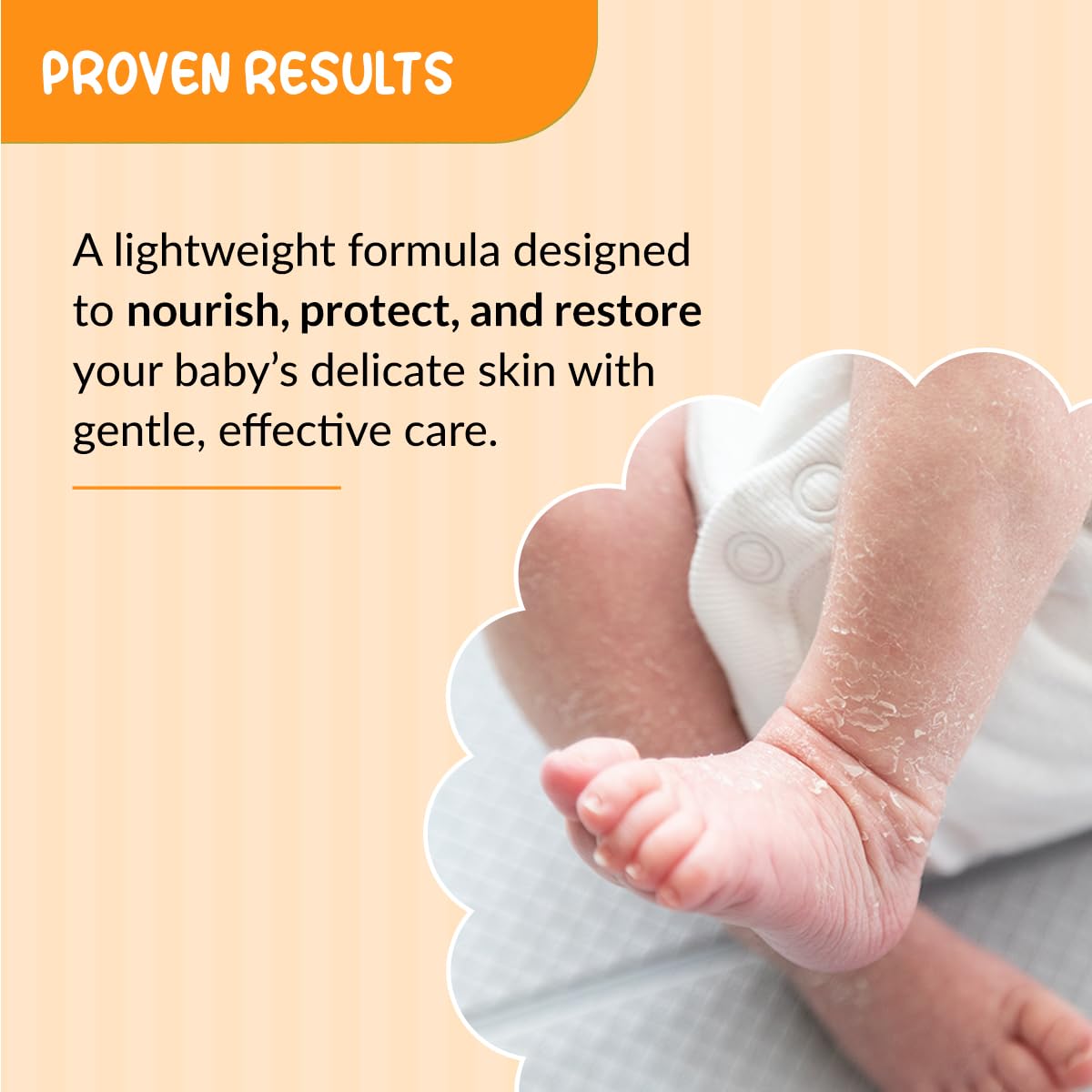 Fixderma Hoopoe Baby Moisturizing Lotion| baby Lotion with 1% Ceramide | Baby Moisturizer for face & Body | Dermatologist Tested (100 Ml) FIX DERMA