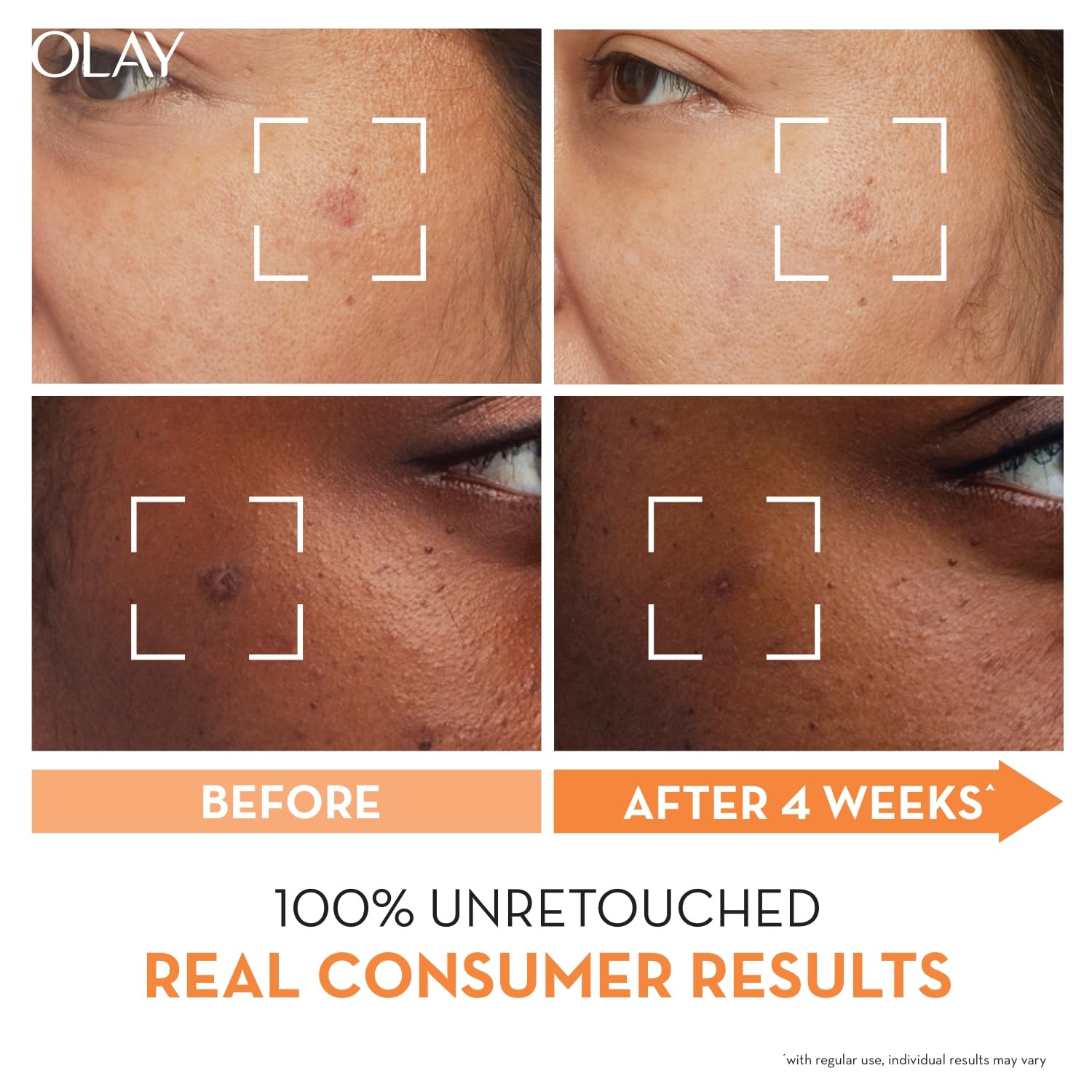 Olay Vitamin C Face Serum with Niacinamide l Even Glow & Smooth Texture l Normal, Oily, Dry & Combination Skin l Parabens & Sulphate-free l 30ml Olay