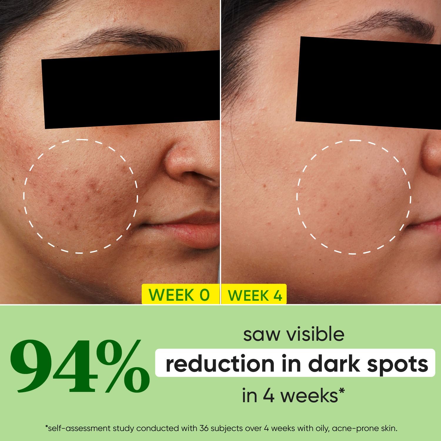 DOT & KEY CICA | +10% Niacinamide Spot Reduction | Face Serum | 20Ml Dot & Key