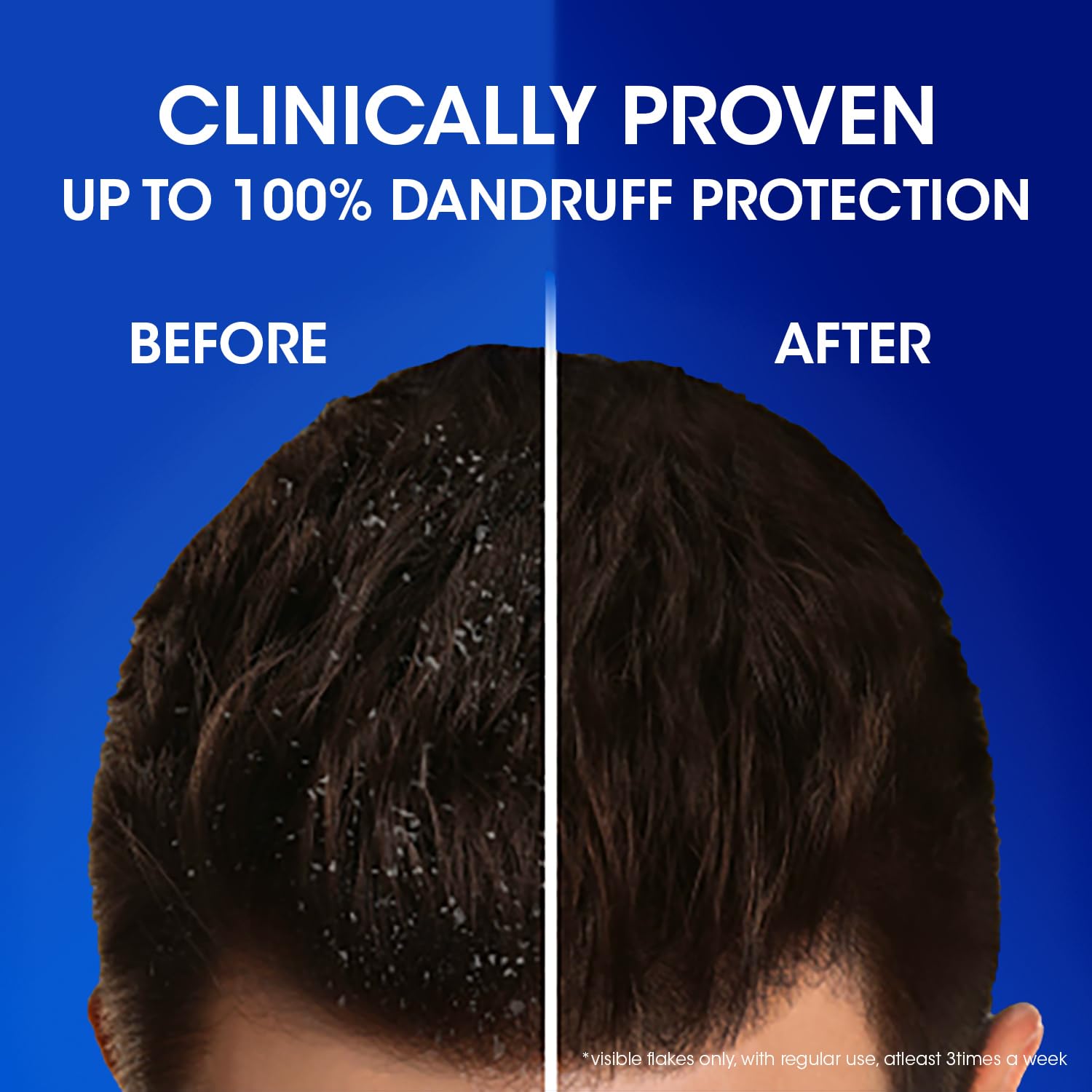 HEAD & SHOULDERS Anti - Dandruff Smooth & Silky Shampoo Smooth Hair From Root To Tip 650 ml Head & Shoulder