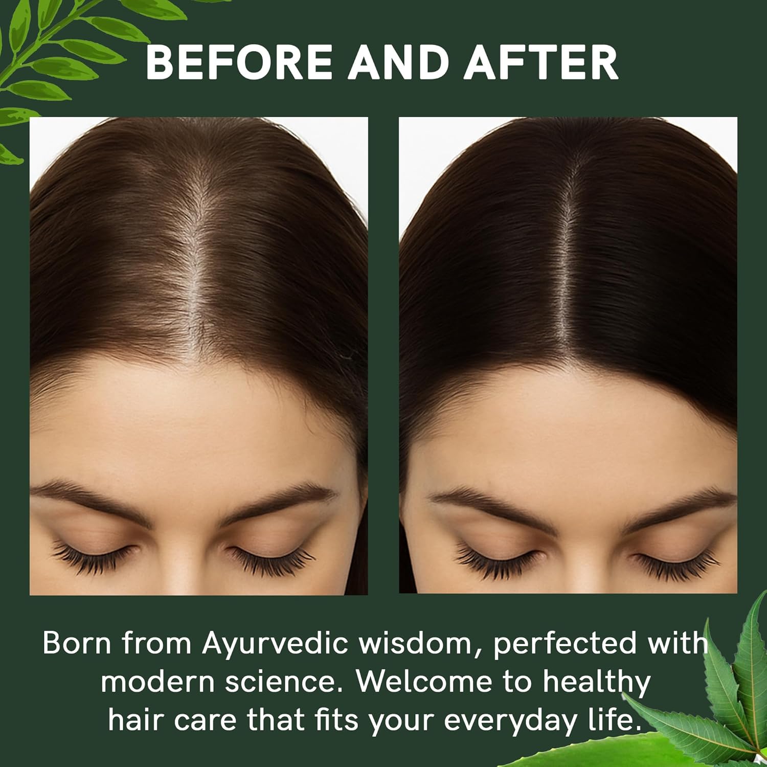 Regrowz Advanced Hair Serum for Men & Women – 50ml | Lightweight Ayurvedic Scalp Serum with Biotin, Aloe Vera, Redensyl & Herbal Extracts | Daily Hair Care for All Hair Types Beauty Bumble