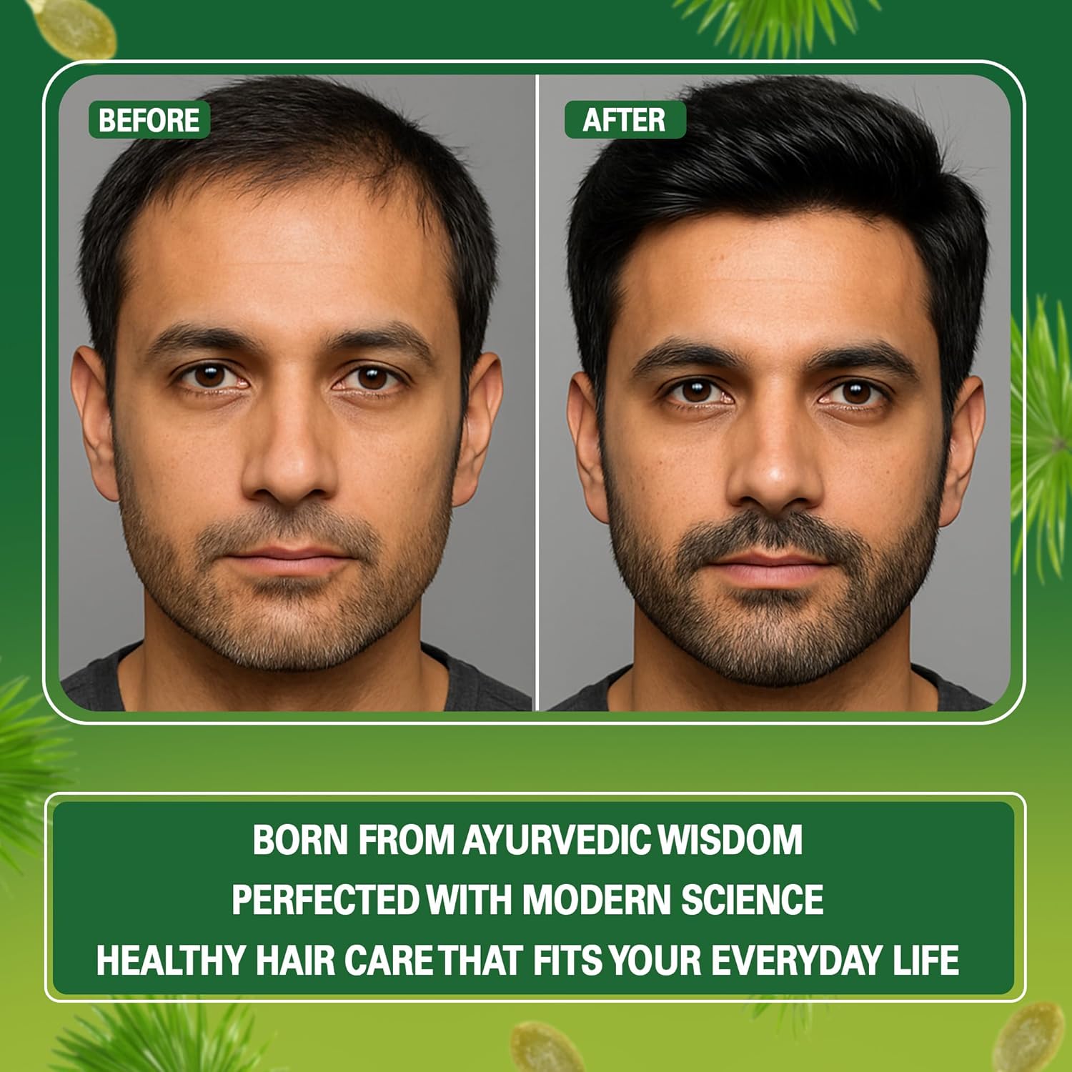 Regrowz Hair Capsules for Men – With Biotin, Pumpkin Seeds & Herbal Extracts | Nutritional Hair Supplement for Well-Groomed, Fuller Appearance, 60 Capsules Beauty Bumble