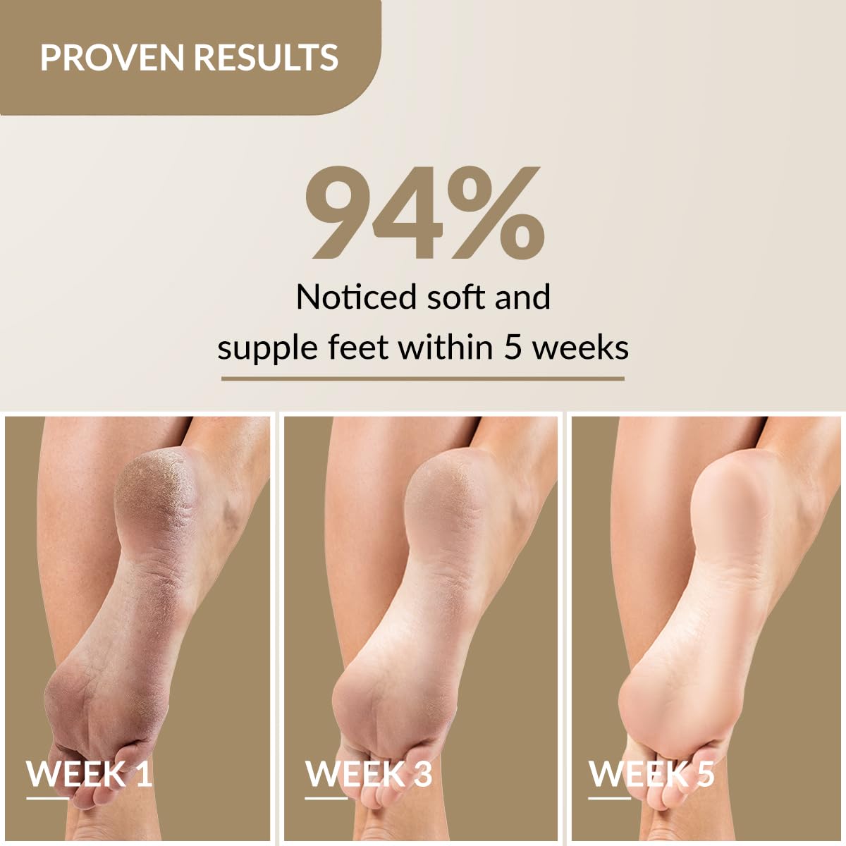 Fixderma Foobetik Cream, Foot cream, Foot Care For Diabetic, For Dry & Cracked Feet, Moisturizes & Soothes Feet, Heel Repair, For Calloused, or Chapped Skin, Paraben Free 50g Fixderma