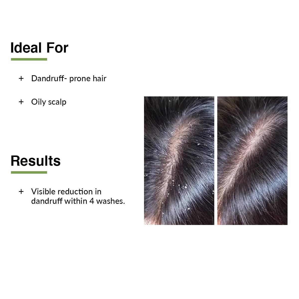 Fixderma Kairfoll Anti Dandruff Shampoo for Oily Sensitive Scalp Prone to Dandruff & Folliculitis | Anti Dandruff Shampoo for Women & Men | Salicylic Acid for Hair Fall | Sulphate Free Shampoo - 100ml Fixderma