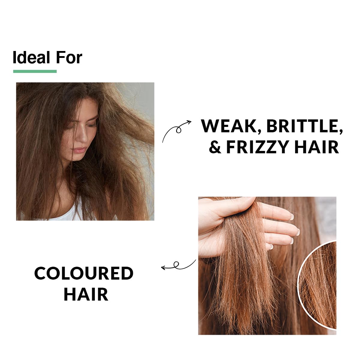 FIXDERMA Kairfoll 15% Red Onion Conditioner With Castor Oil For Hair Growth, Bond Repair Conditioner For Coloured Hair, Conditioner For Women, Conditioners For Dry & Frizzy Hair - 200 Millilitre Fixderma