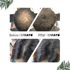 Kerrato Hair Thickening Fibers 4 gms Kerrato
