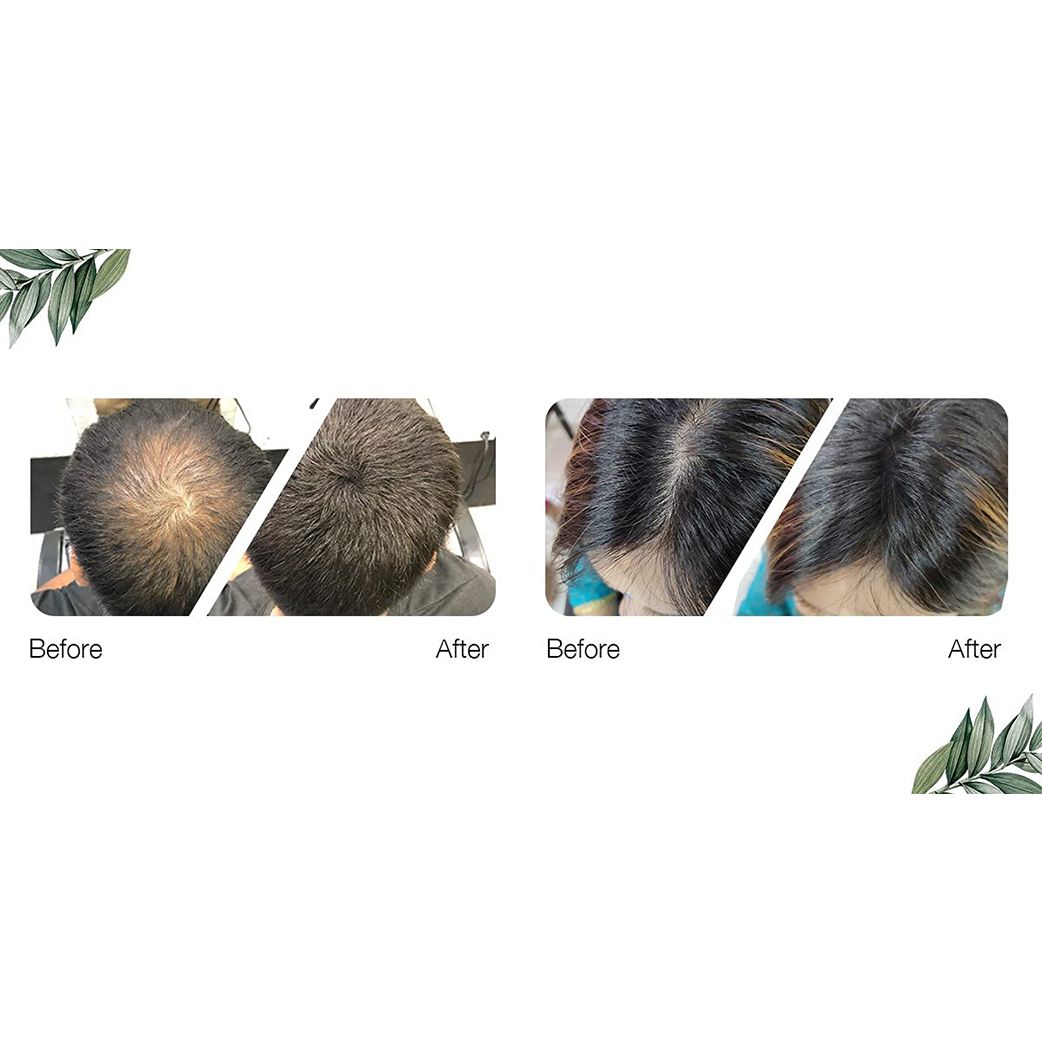 Kerrato Hair Thickening Fibers 28 gms - Dark Brown Kerrato