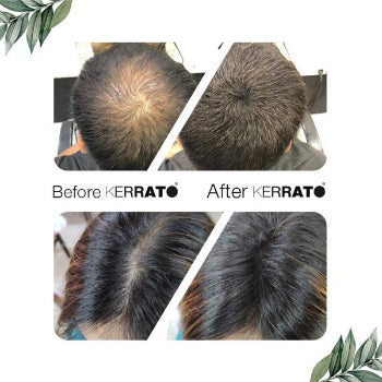 Kerrato Hair Thickening Fibers 28 gms - Medium Brown Kerrato